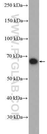 Nurr1/NR4A2 Antibody in Western Blot (WB)