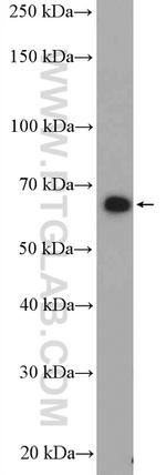 Nurr1/NR4A2 Antibody in Western Blot (WB)