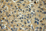 STXBP6 Antibody in Immunohistochemistry (Paraffin) (IHC (P))