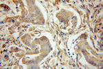 PLK3 Antibody in Immunohistochemistry (Paraffin) (IHC (P))