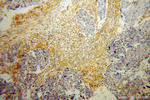 HSD17B2 Antibody in Immunohistochemistry (Paraffin) (IHC (P))