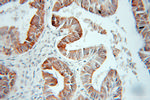 HSD17B2 Antibody in Immunohistochemistry (Paraffin) (IHC (P))