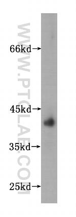 HSD17B2 Antibody in Western Blot (WB)