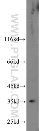 HSD17B2 Antibody in Western Blot (WB)