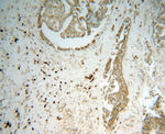 GRP94 Antibody in Immunohistochemistry (Paraffin) (IHC (P))