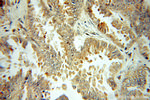 GRP94 Antibody in Immunohistochemistry (Paraffin) (IHC (P))