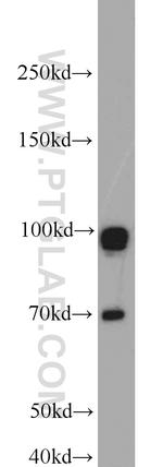 GRP94 Antibody in Western Blot (WB)