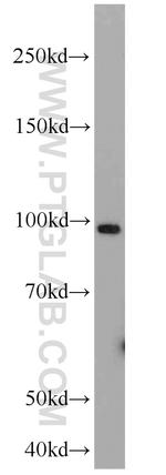 GRP94 Antibody in Western Blot (WB)