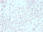 Kindlin-2/KIND2 Antibody in Immunohistochemistry (Paraffin) (IHC (P))