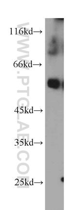 Fc epsilon RI alpha Antibody in Western Blot (WB)