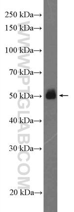 Fc epsilon RI alpha Antibody in Western Blot (WB)