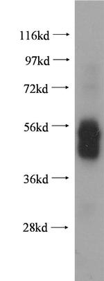 Fc epsilon RI alpha Antibody in Western Blot (WB)