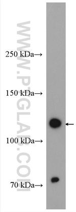 OSMR Antibody in Western Blot (WB)