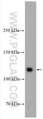 OSMR Antibody in Western Blot (WB)