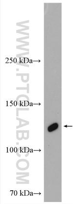 OSMR Antibody in Western Blot (WB)