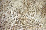 PICK1 Antibody in Immunohistochemistry (Paraffin) (IHC (P))