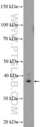 MRPS22 Antibody in Western Blot (WB)