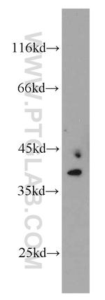 MRPS22 Antibody in Western Blot (WB)