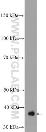 MRPS22 Antibody in Western Blot (WB)