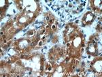 GRIM19 Antibody in Immunohistochemistry (Paraffin) (IHC (P))