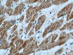 GRIM19 Antibody in Immunohistochemistry (Paraffin) (IHC (P))