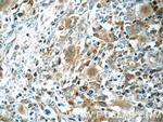 WASP Antibody in Immunohistochemistry (Paraffin) (IHC (P))