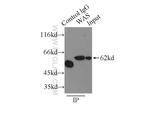 WASP Antibody in Immunoprecipitation (IP)