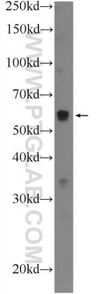 WASP Antibody in Western Blot (WB)