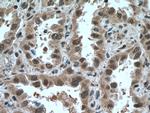 SKP1 Antibody in Immunohistochemistry (Paraffin) (IHC (P))