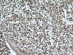 SKP1 Antibody in Immunohistochemistry (Paraffin) (IHC (P))