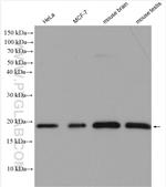 SKP1 Antibody in Western Blot (WB)