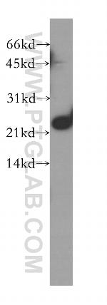 SKP1 Antibody in Western Blot (WB)