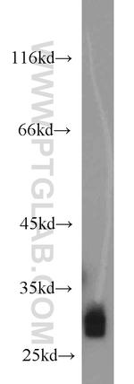 FHL1 Antibody in Western Blot (WB)