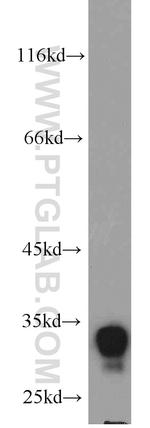 FHL1 Antibody in Western Blot (WB)