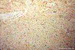 CSNK2A1 Antibody in Immunohistochemistry (Paraffin) (IHC (P))