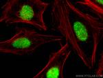 CSNK2A1 Antibody in Immunocytochemistry (ICC/IF)