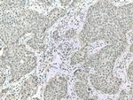 CSNK2A1 Antibody in Immunohistochemistry (Paraffin) (IHC (P))