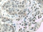 CSNK2A1 Antibody in Immunohistochemistry (Paraffin) (IHC (P))