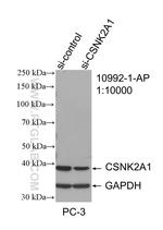 CSNK2A1 Antibody in Western Blot (WB)