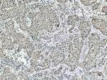 CSNK2A1 Antibody in Immunohistochemistry (Paraffin) (IHC (P))