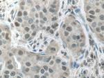 CSNK2A1 Antibody in Immunohistochemistry (Paraffin) (IHC (P))