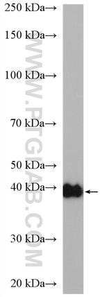 CSNK2A1 Antibody in Western Blot (WB)