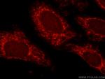 ATP5O Antibody in Immunocytochemistry (ICC/IF)