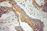 ATP5O Antibody in Immunohistochemistry (Paraffin) (IHC (P))