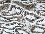 ATP5O Antibody in Immunohistochemistry (Paraffin) (IHC (P))