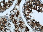 ATP5O Antibody in Immunohistochemistry (Paraffin) (IHC (P))