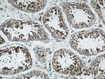 ATP5O Antibody in Immunohistochemistry (Paraffin) (IHC (P))