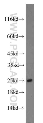 ATP5O Antibody in Western Blot (WB)