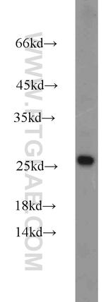 ATP5O Antibody in Western Blot (WB)