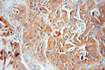 HSP70 Antibody in Immunohistochemistry (Paraffin) (IHC (P))